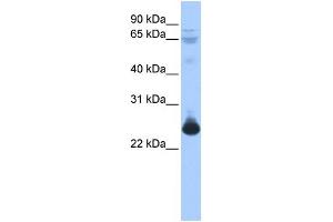 Image no. 1 for anti-Transcription Elongation Factor A (SII)-Like 1 (TCEAL1) (Middle Region) antibody (ABIN2780618)