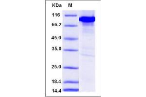 Image no. 1 for Calcium/calmodulin-Dependent Protein Kinase IV (CAMK4) (AA 1-469) protein (GST tag,His tag) (ABIN2008360)