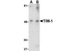 Image no. 1 for anti-Hepatitis A Virus Cellular Receptor 1 (HAVCR1) (Center) antibody (ABIN2476808)