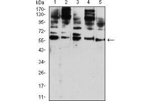Image no. 4 for anti-CD209 (CD209) (AA 270-404) antibody (ABIN5611274)