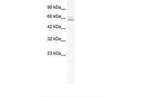Image no. 1 for anti-Zinc Finger Protein 141 (ZNF141) (AA 143-192) antibody (ABIN202617)