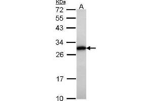 WB Image Sample (30 ug of whole cell lysate) A: Raji 12% SDS PAGE GRB2 antibody antibody diluted at 1:1000