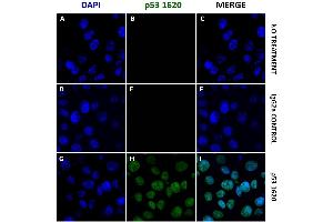 Immunocytochemistry (ICC) image for anti-Tumor Protein P53 (TP53) (Wild Type) antibody (ABIN2704419)