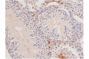 Image no. 4 for anti-Mast/stem Cell Growth Factor Receptor (KIT) (pTyr703) antibody (ABIN6255994)