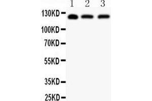 Image no. 2 for anti-Sirtuin 1 (SIRT1) (AA 112-311) antibody (ABIN3042483)