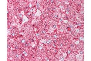 Anti-MINK1 / MAP4K6 antibody IHC of human liver.