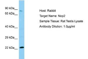 Image no. 1 for anti-Nucleolar Protein 1 (NOL1) (N-Term) antibody (ABIN2783408)