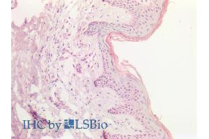ABIN1019658 (5µg/ml) staining of paraffin embedded Human Skin.