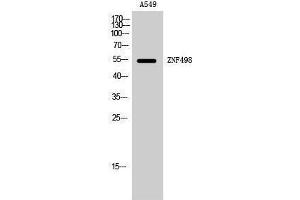 Image no. 1 for anti-Zinc Finger and SCAN Domain Containing 25 (ZSCAN25) (Internal Region) antibody (ABIN3187556)