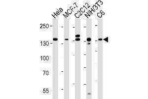 anti-Regulatory Associated Protein of mTOR, Complex 1 (RPTOR) antibody