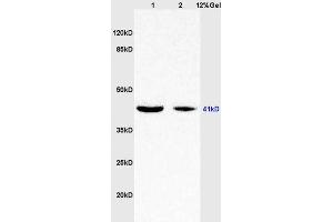 Image no. 2 for anti-Wingless-Type MMTV Integration Site Family, Member 7A (WNT7A) (AA 241-349) antibody (ABIN719336)