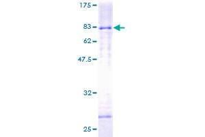 Image no. 1 for Histone Deacetylase 3 (HDAC3) (AA 1-428) protein (GST tag) (ABIN1306448)