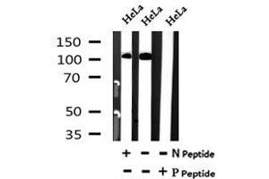 Image no. 4 for anti-BTB and CNC Homology 1, Basic Leucine Zipper Transcription Factor 1 (BACH1) (pSsr445) antibody (ABIN6269595)