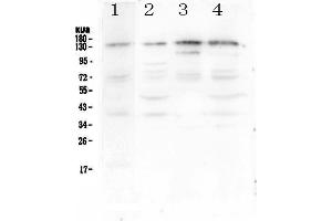 Image no. 1 for anti-Epidermal Growth Factor Receptor Pathway Substrate 15 (EPS15) (AA 2-88) antibody (ABIN5693046)