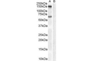 Image no. 2 for anti-Monoamine Oxidase B (MAOB) (Internal Region) antibody (ABIN185506)