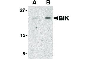 Image no. 1 for anti-BCL2-Interacting Killer (Apoptosis-Inducing) (BIK) (N-Term) antibody (ABIN6655841)