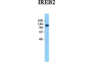 Image no. 3 for anti-Iron-Responsive Element Binding Protein 2 (IREB2) (Middle Region) antibody (ABIN2778884)