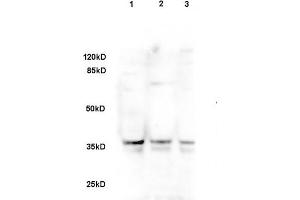 Image no. 2 for anti-delta-Like 1 Homolog (Drosophila) (DLK1) (AA 251-350) antibody (ABIN740055)