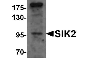 Image no. 2 for anti-Salt-Inducible Kinase 2 (SIK2) (Middle Region) antibody (ABIN1031093)