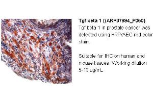 Image no. 3 for anti-Transforming Growth Factor, beta 1 (TGFB1) (Middle Region) antibody (ABIN2780306)