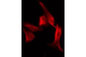 Image no. 6 for anti-Insulin Receptor Substrate 1 (IRS1) (pSer636) antibody (ABIN6255436)