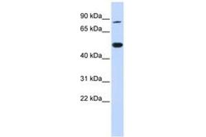 Image no. 1 for anti-tRNA Methyltransferase 1 (TRMT1) (AA 36-85) antibody (ABIN6742489)