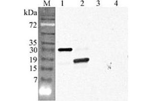 Image no. 1 for anti-C1q and Tumor Necrosis Factor Related Protein 5 (C1QTNF5) (Globular Domain) antibody (ABIN1169283)
