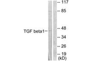 Image no. 1 for anti-Transforming Growth Factor, beta 1 (TGFB1) (AA 336-385) antibody (ABIN1533412)