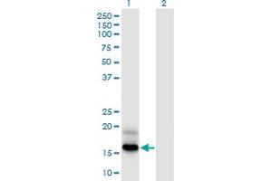 Image no. 2 for anti-Prefoldin Subunit 4 (PFDN4) (AA 1-134) antibody (ABIN948244)