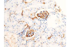 Image no. 4 for anti-Checkpoint Kinase 1 (CHEK1) (pSer286) antibody (ABIN6255167)
