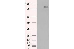 Image no. 3 for anti-L1 Cell Adhesion Molecule (L1CAM) antibody (ABIN2717356)