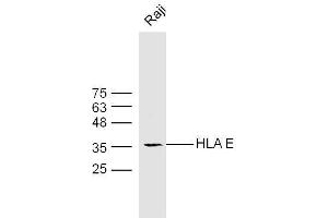 Raji cell lysates probed with Rabbit Anti-HLA E Polyclonal Antibody  at 1:300 overnight at 4˚C.