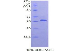 Image no. 1 for Receptor-Interacting serine-threonine Kinase 3 (RIPK3) protein (ABIN3011436)