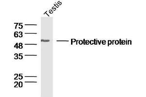 Image no. 2 for anti-Cathepsin A (CTSA) (AA 401-480) antibody (ABIN2178715)