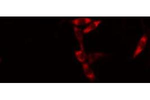 Image no. 1 for anti-Absent in Melanoma 2 (AIM2) (Internal Region) antibody (ABIN6256925)