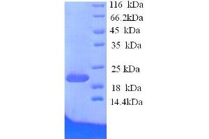 Ephrin A1 (EFNA1) (AA 18-182), (full length) protein (His tag)