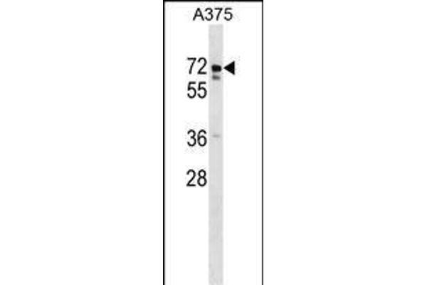 USP17L2 Antikörper  (C-Term)
