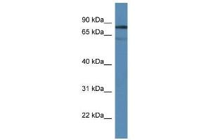 Image no. 1 for anti-Tyrosyl-DNA Phosphodiesterase 1 (TDP1) (Middle Region) antibody (ABIN928939)