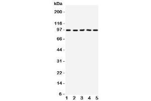 Image no. 5 for anti-Neurotrophic tyrosine Kinase, Receptor, Type 3 (NTRK3) (AA 167-182) antibody (ABIN3028867)