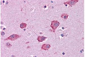 Image no. 2 for anti-Hepatocyte Growth Factor (Hepapoietin A, Scatter Factor) (HGF) (AA 216-265) antibody (ABIN604744)