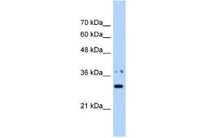 Image no. 1 for anti-Nicotinamide Nucleotide Adenylyltransferase 1 (NMNAT1) (N-Term) antibody (ABIN629615)