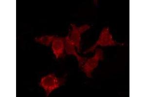 Image no. 2 for anti-MAS-Related GPR, Member X4 (MRGPRX4) (C-Term) antibody (ABIN6263354)