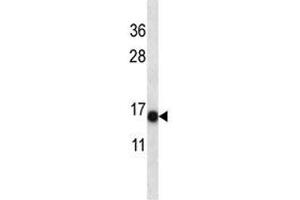 Image no. 3 for anti-S100 Calcium Binding Protein A7 (S100A7) (AA 2-31) antibody (ABIN3032514)