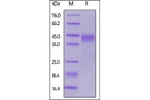 Image no. 1 for Leukemia Inhibitory Factor (LIF) (AA 23-202) protein (His tag,AVI tag,Biotin) (ABIN5954922)