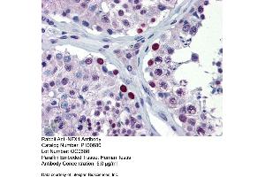 Image no. 2 for anti-Nuclear Transcription Factor, X-Box Binding 1 (NFX1) (Middle Region) antibody (ABIN2792551)