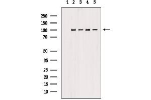 Image no. 4 for anti-Proteasome (Prosome, Macropain) 26S Subunit, Non-ATPase, 2 (PSMD2) antibody (ABIN6264489)
