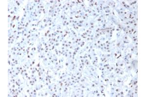 Image no. 2 for anti-Wilms Tumor 1 (WT1) (AA 1-181) antibody (ABIN6940900)