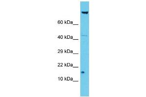 Image no. 1 for anti-NADH Dehydrogenase (Ubiquinone) 1 alpha Subcomplex, 12 (NDUFA12) (N-Term) antibody (ABIN2791134)