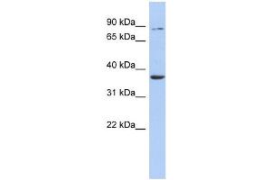 Image no. 1 for anti-Heparan Sulfate (Glucosamine) 3-O-Sulfotransferase 1 (HS3ST1) antibody (ABIN634065)