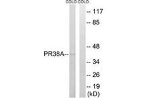 Image no. 1 for anti-PRP38 Pre-mRNA Processing Factor 38 (Yeast) Domain Containing A (PRPF38A) (AA 104-153) antibody (ABIN1535201)